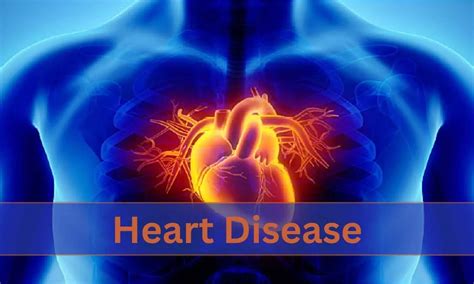 Elevated plasma methylmalonic acid levels associated with increased CV ...