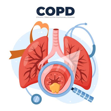 Pulmonary Disease PNG, Vector, PSD, and Clipart With Transparent - Clip ...