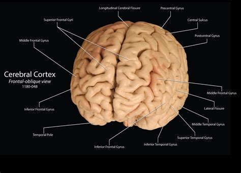 Lateral Fissure Brain