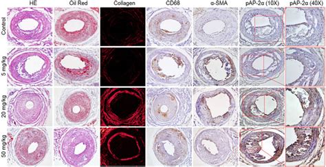 Oncotarget | Activation of activator protein 2 alpha by aspirin alleviates atherosclerotic ...