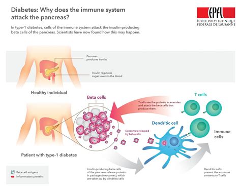 Infographic [IMAGE] | EurekAlert! Science News Releases