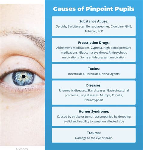 Why Do I Have Pinpoint Pupils? 6 Causes – NVISION