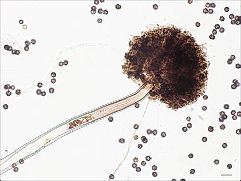 Aspergillus niger - Alchetron, The Free Social Encyclopedia