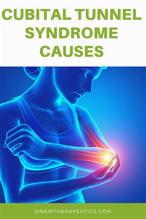 91 best Cubital Tunnel Syndrome images on Pinterest | Sports medicine, Elbow pain and Role play