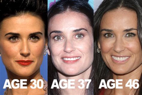 Demi Moore Plastic Surgery Before and After Breast Implants and ...