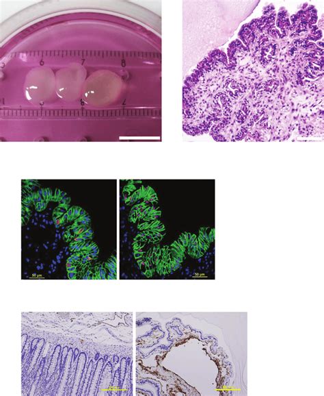 Characterization ofintestinal organoids from human embryonic stem ...