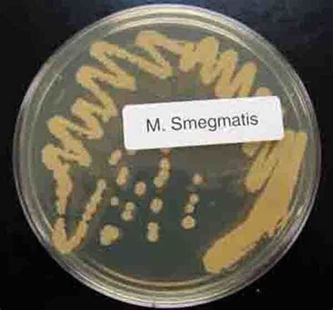 Mycobacterium smegmatis ~ Everything You Need to Know with Photos | Videos