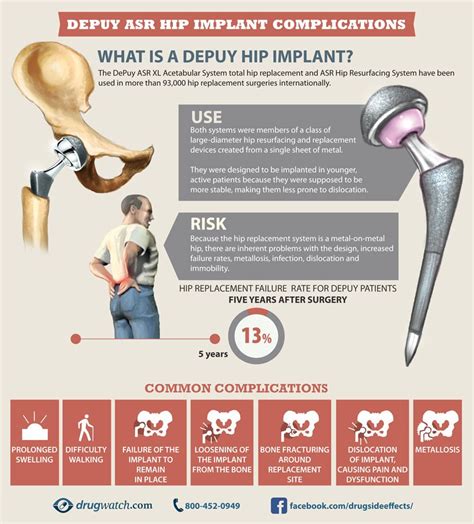 Pin on Medical Devices Information