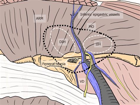 Anatomy Of Men's Groin Area ~ Diagram Of Groin Area | Efferisect