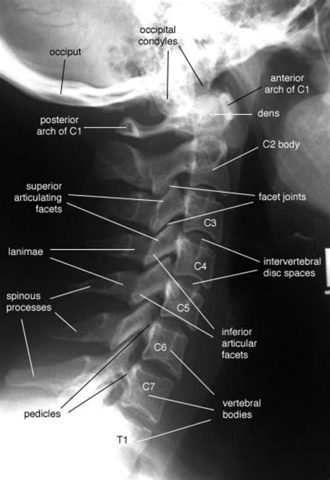 Pin by Kris Lacosta on ANATOMÍA RADIOLÓGICA | Radiology student ...