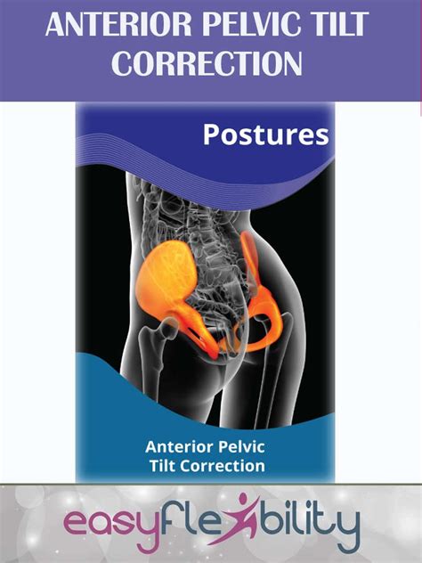 Posterior Pelvic Tilt Correction – EasyFlexibility