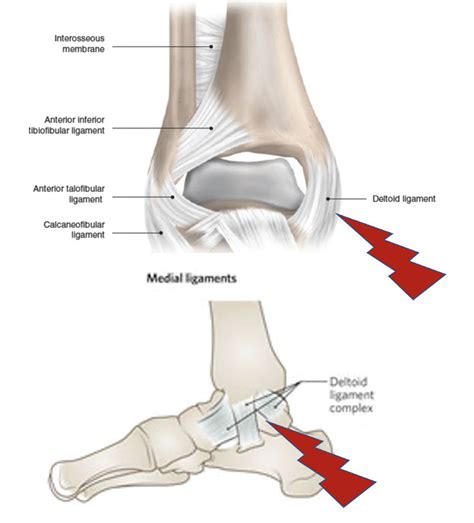 Medial Malleolus