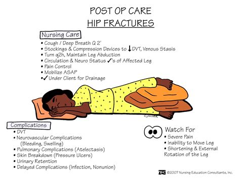 Hip Fractures - Fracture Treatment