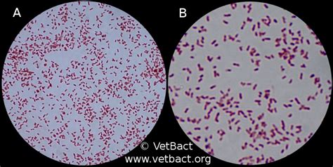 Bordetella Pertussis Gram Stain