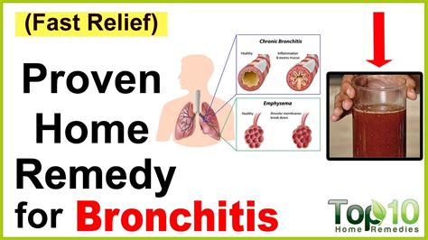 A Quick Home Remedy for Bronchitis - YouTube