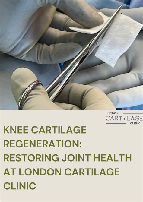 PPT - Knee Cartilage Regeneration Restoring Joint Health at London ...