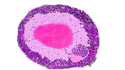 General Pathology - Pathology Made Simple