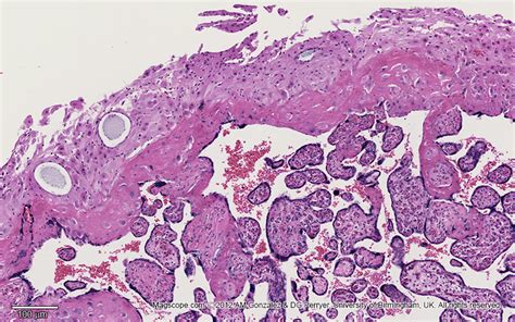 Placenta Histology Decidua