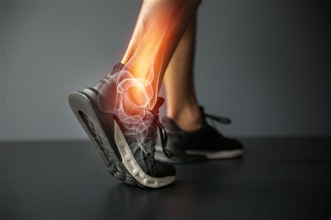 Ankle injury and Joint pain-Sports injuries