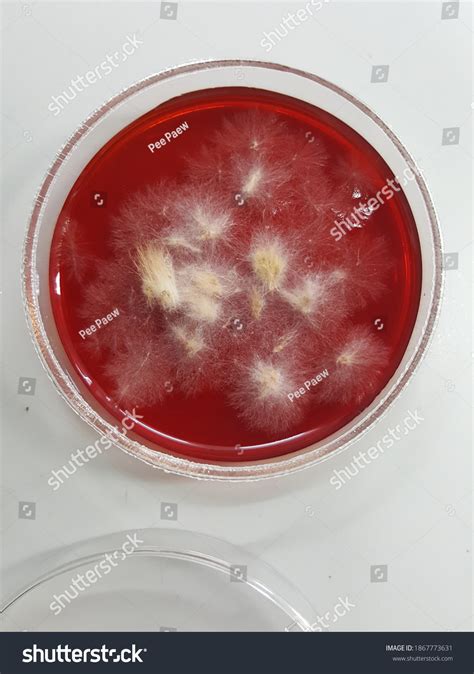 Dermatophyte Test Medium Dtm Culture Petri Stock Photo 1867773631 | Shutterstock