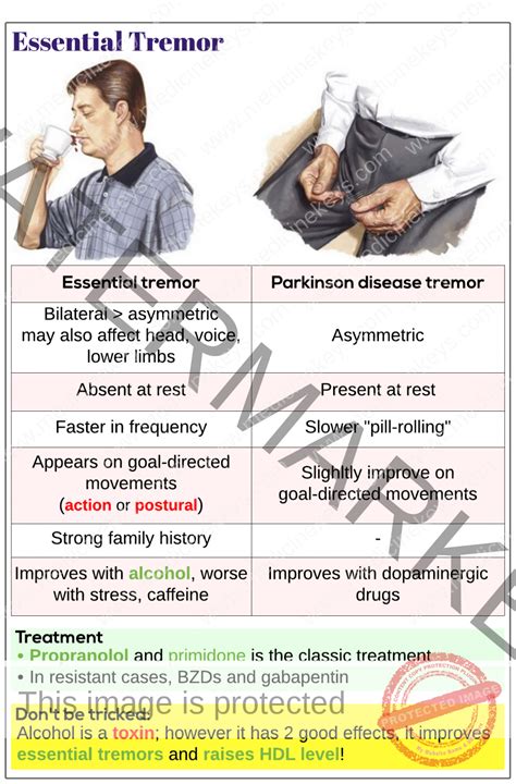 Essential tremor - Medicine Keys for MRCPs