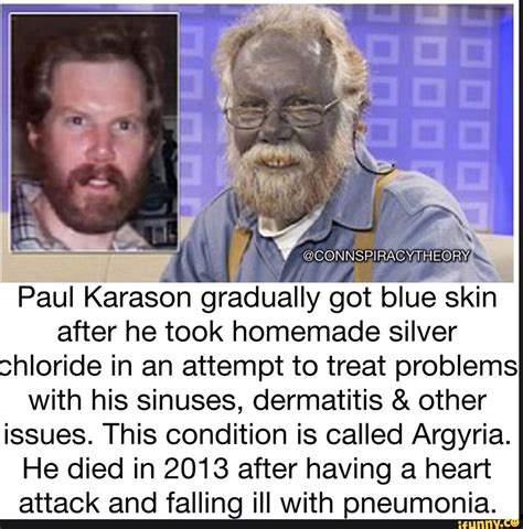 CONNSPIRACY THE I Paul Karason gradually got blue skin after he took homemade silver chloride in ...