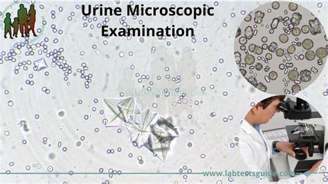 Urine Microscopic Examination | Lab Tests Guide