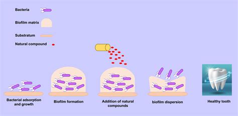 Antibacterial effects of natural compounds on biofilm formation of Streptococcus mutans ...