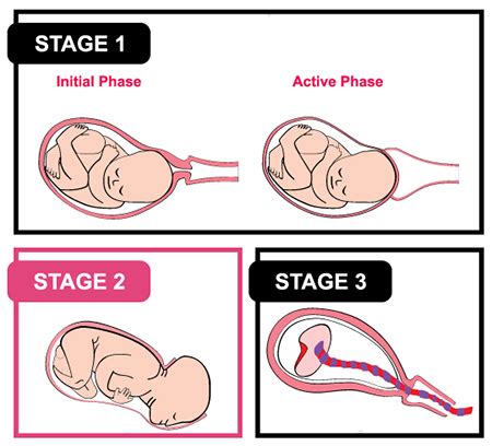 The Four Stages Of Labour Part | tunersread.com