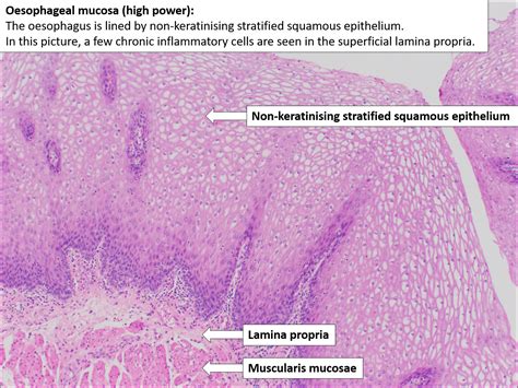 Esophagus Histology