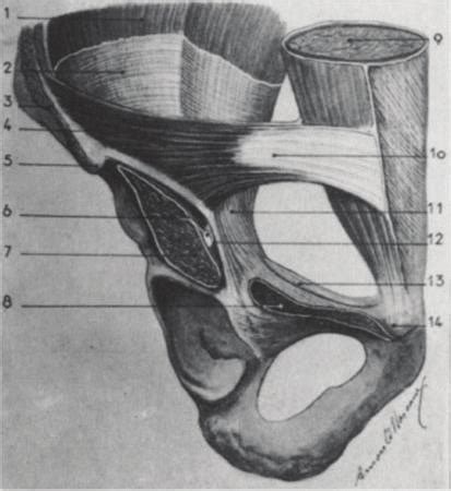 The myopectineal orifice: 1 = iliacus muscle; 2 = fascia iliaca; 3 ...