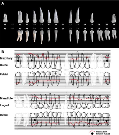 A: Odontogram with FDI World Dental Federation numbering system; B ...