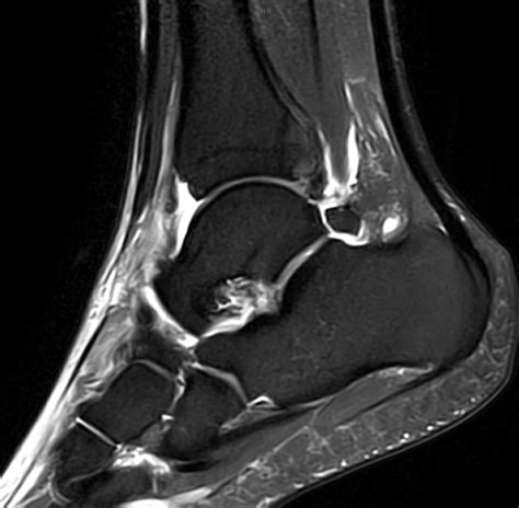 Foot & Ankle MRI Course - MSK Radiology Mini Fellowship - MRI Online