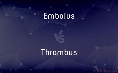 Embolus vs. Thrombus — What’s the Difference?