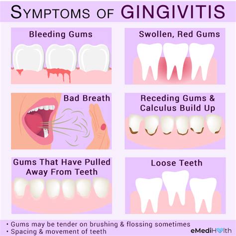 Gingivitis 101: Types, Causes, Treatment, and Risk Factors