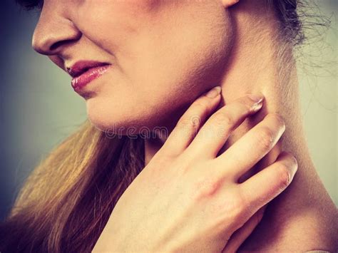 Woman Scratching Her Itchy Neck with Allergy Rash Stock Photo - Image of allergic, dermatology ...