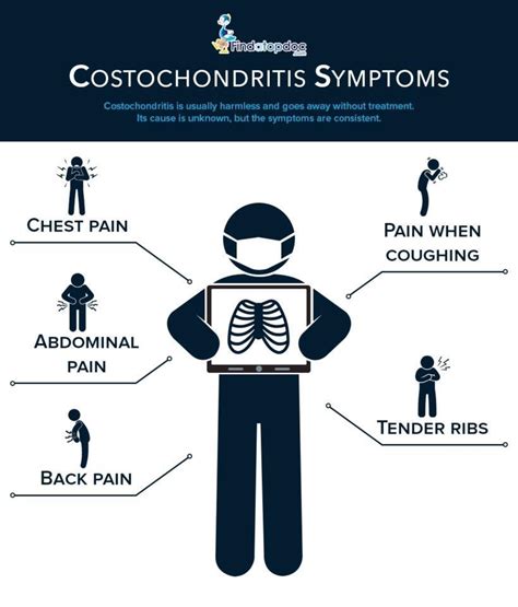 What Is Costochondritis What Are The Symptoms Of Costochondritis | HOT SEXY GIRL