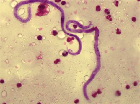 [16-04-2021] Weekly blood parasite picture quiz : r/ClinicalMicrobiology