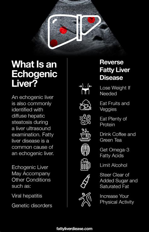 Echogenic Liver: What Does It Mean? | Fatty Liver Disease