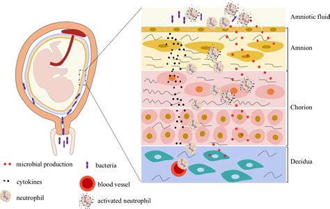 Chorioamnionitis