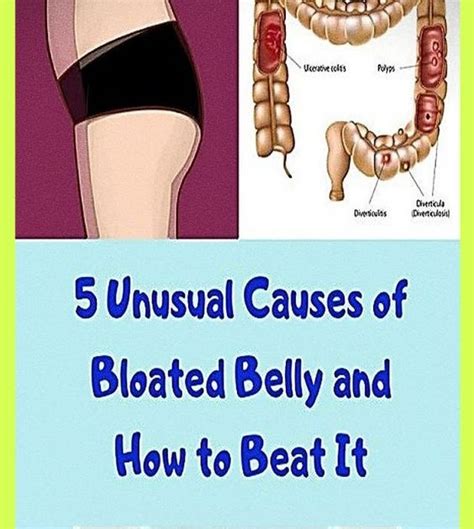 5 Unusual Causes of Bloated Belly and How to Beat It - wellness topic