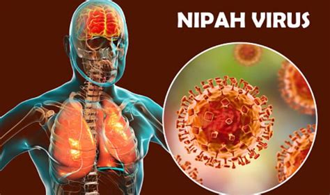 Condition of Student With Nipah Stable, 5 Others Kept in Isolation