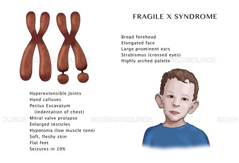 Genetic and Inherited disorders Diagram | Quizlet