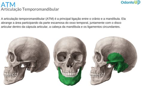 ATM – Articulação Temporomandibular | OdontoUP