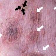 Pyoderma in the Dog | Today's Veterinary Nurse