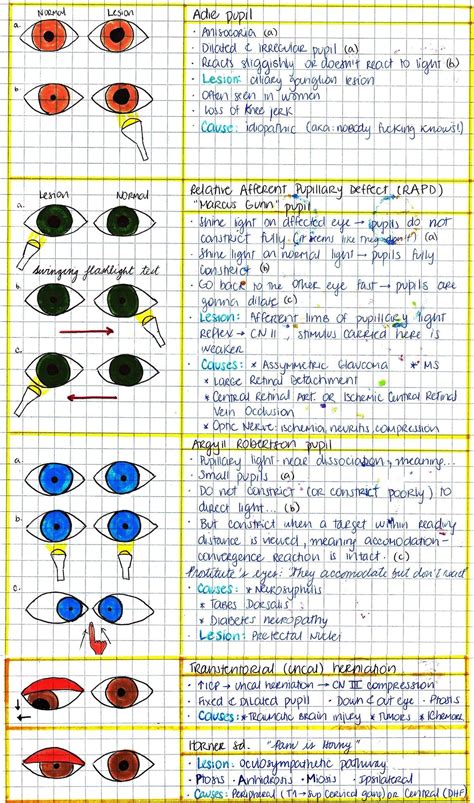 My Notes for USMLE | Optometry education, Eye facts, Optometry