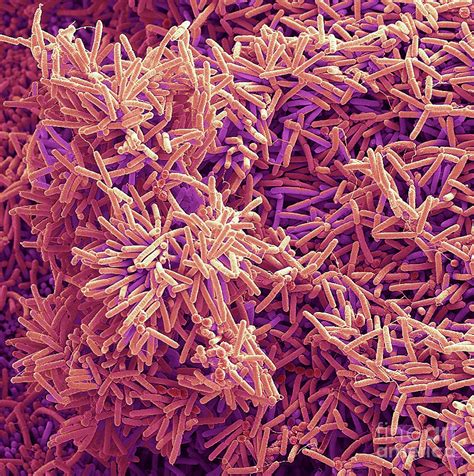 Plaque-forming Bacteria Photograph by Steve Gschmeissner/science Photo Library - Pixels