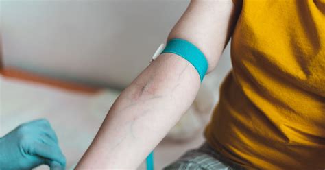 Green Veins: Why They’re That Color, Plus Conditions to Be Aware Of