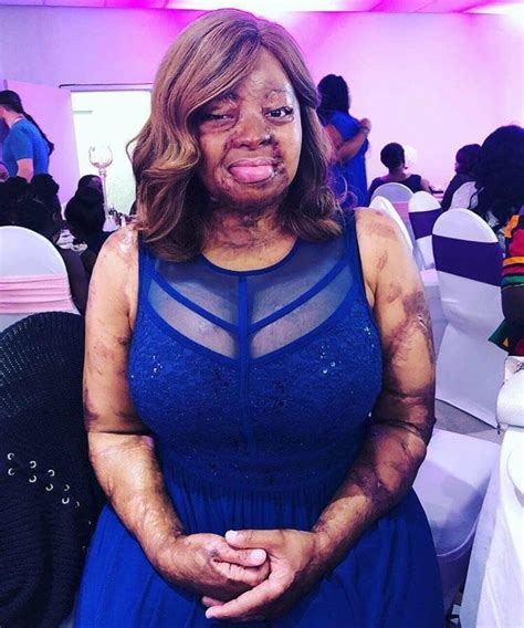 Kechi Okwuchi undergoes another surgery - Kemi Filani News