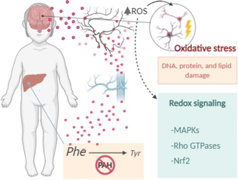 Oxidative stress in phenylketonuria. PAH: phenylalanine hydroxylase;... | Download Scientific ...